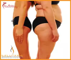 Slider image (5) Salutaris Medical Center